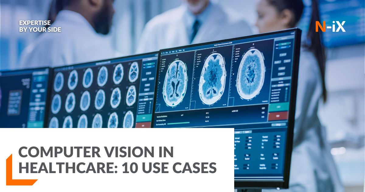 Computer vision in healthcare: Best use cases - N-iX